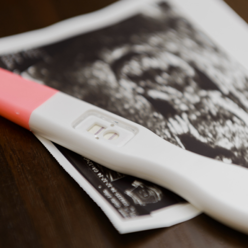 9ª Câmara aplica entendimento do STF e reconhece estabilidade a gestante em contrato temporário